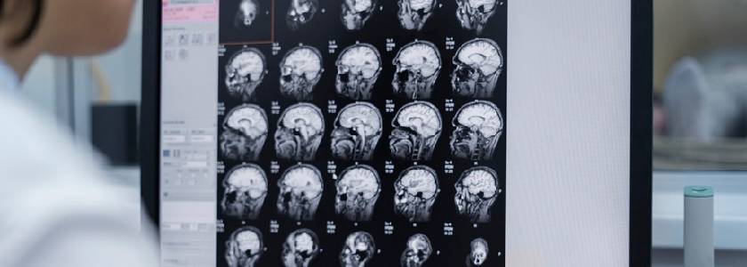 Head Injury Surgeon in Haryana