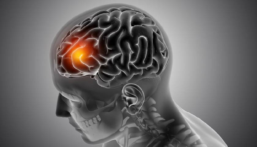 Brain Stroke Treatment In Narnaul
