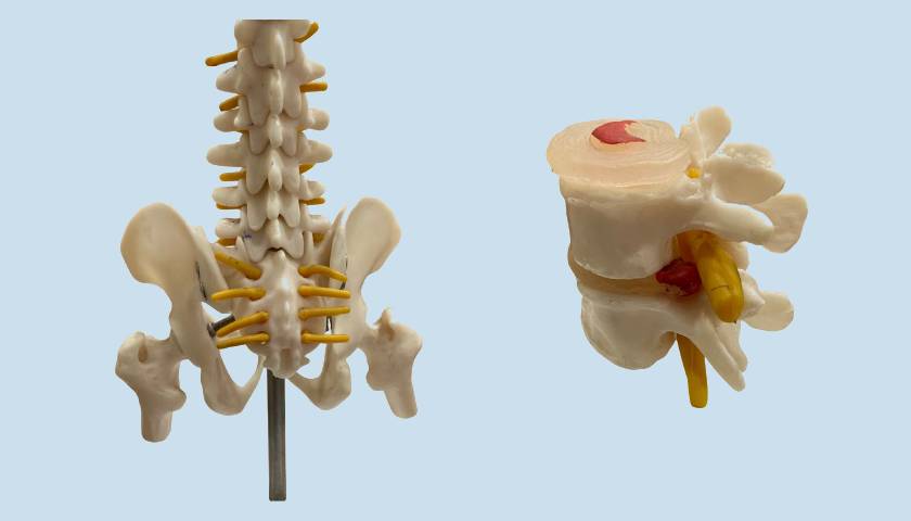 Lumbar Spine Surgery In Narnaul