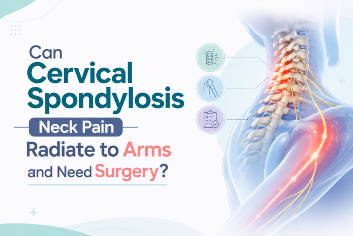 Illustration of cervical spondylosis showing neck pain radiating to arms, highlighting nerve compression and treatment options by Dr Kavindra Singh in Narnaul, Haryana.